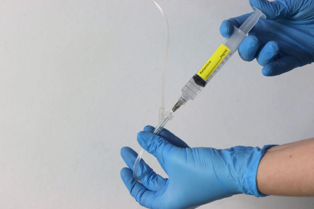 Ketamine IV Treatment
